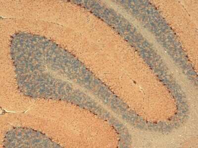 Immunohistochemistry: HCN1 Antibody (S70) [NBP1-22450]