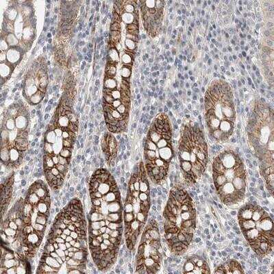 Immunohistochemistry: HCN3 Antibody [NBP1-81402]