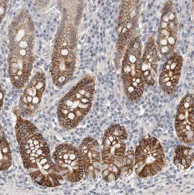 Immunohistochemistry-Paraffin: HCN3 Antibody [NBP1-81402]