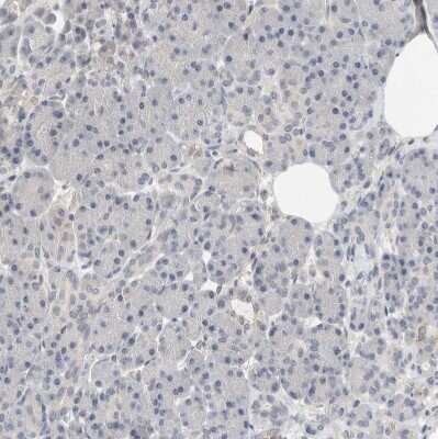 Immunohistochemistry-Paraffin: HCN3 Antibody [NBP1-81402]