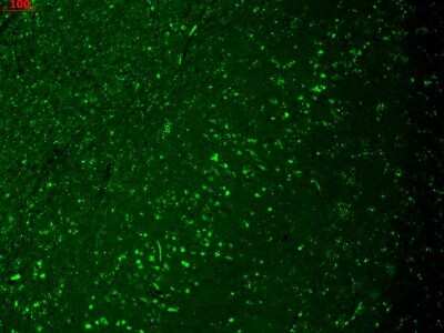 Immunohistochemistry: HCN4 Antibody (S114/10) [NBP2-12910]