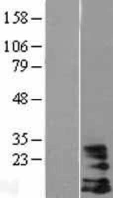Western Blot: DAP10/HCST Overexpression Lysate [NBL1-11476]