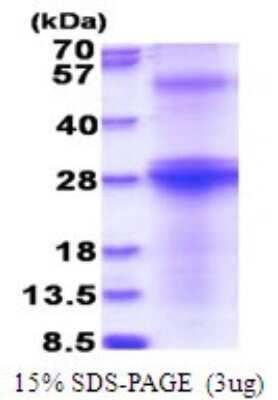 SDS-PAGE: Recombinant HCV-E2 His Protein [NBP2-51770]