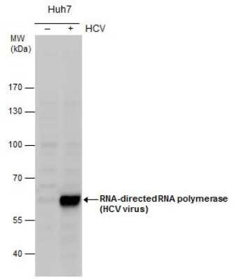 Western Blot: HCV-NS5b Antibody [NBP3-13011]