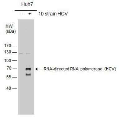 Western Blot: HCV-NS5b Antibody [NBP3-13012]
