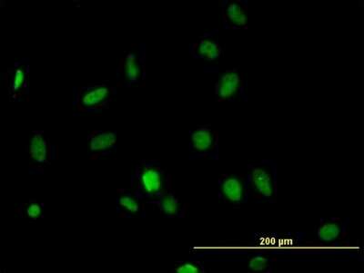 Immunocytochemistry/ Immunofluorescence: HDAC1 Antibody (1D6) [H00003065-M06]