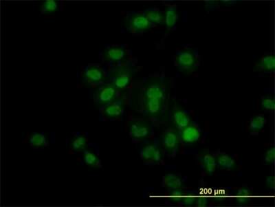 Immunocytochemistry/ Immunofluorescence: HDAC1 Antibody (5C11) [H00003065-M14]