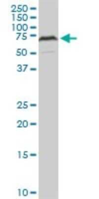Western Blot: HDAC1 Antibody (5C11) [H00003065-M14]