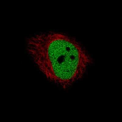 Immunocytochemistry/ Immunofluorescence: HDAC1 Antibody (CL0510) [NBP2-52937]