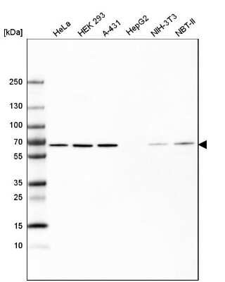 Western Blot: HDAC1 Antibody (CL0510) [NBP2-52937]
