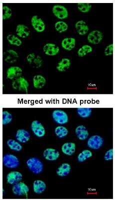 Immunocytochemistry/ Immunofluorescence: HDAC1 Antibody [NBP1-31294]