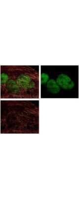Immunocytochemistry/ Immunofluorescence: HDAC1 Antibody [NBP1-78101]