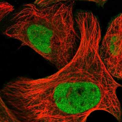 Immunocytochemistry/ Immunofluorescence: HDAC1 Antibody [NBP1-83350]