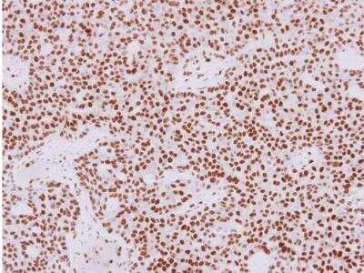 Immunohistochemistry-Paraffin: HDAC1 Antibody [NBP1-31294]