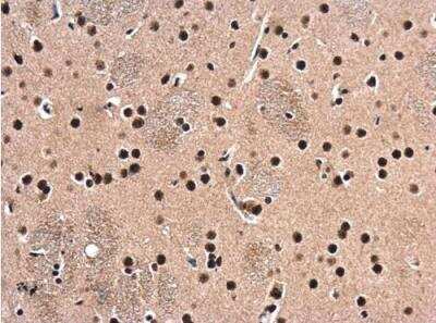 Immunohistochemistry-Paraffin: HDAC1 Antibody [NBP1-31294]