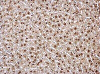 Immunohistochemistry-Paraffin: HDAC1 Antibody [NBP1-31294]