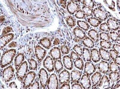 Immunohistochemistry-Paraffin: HDAC1 Antibody [NBP1-31294]
