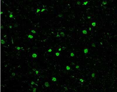 Immunohistochemistry-Paraffin: HDAC1 Antibody [NBP1-31294]