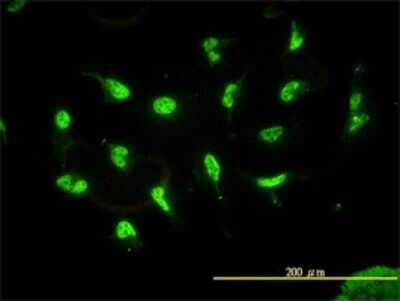 Immunocytochemistry/ Immunofluorescence: HDAC11 Antibody (1C2-2G5) [H00079885-M01]