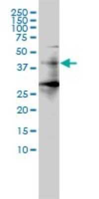 Western Blot: HDAC11 Antibody (1C2-2G5) [H00079885-M01]