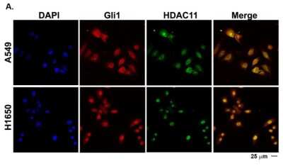 Immunocytochemistry/ Immunofluorescence: HDAC11 Antibody [NBP2-16789]