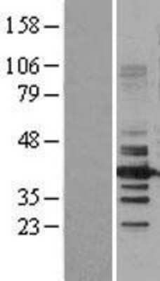 Western Blot: HDAC11 Overexpression Lysate [NBL1-11479]