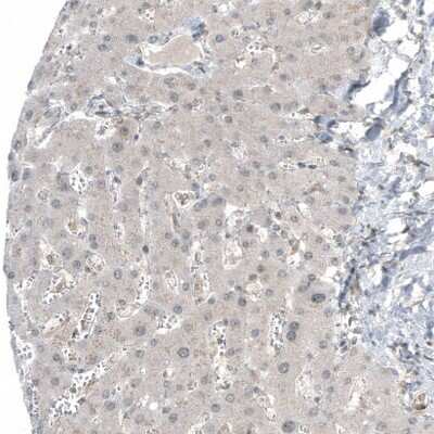 Immunohistochemistry-Paraffin: HDAC5 Antibody (CL8121) [NBP2-88913]