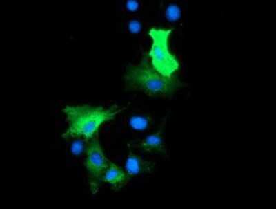 Immunocytochemistry/ Immunofluorescence: HDAC6 Antibody (OTI1B3) [NBP2-03269]