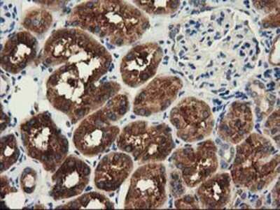 Immunohistochemistry-Paraffin: HDAC6 Antibody (OTI1B3) [NBP2-03269]
