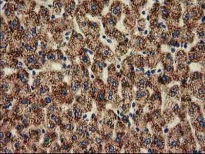 Immunohistochemistry-Paraffin: HDAC6 Antibody (OTI1B3) [NBP2-03269]
