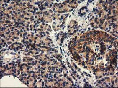 Immunohistochemistry-Paraffin: HDAC6 Antibody (OTI1B3) [NBP2-03269]