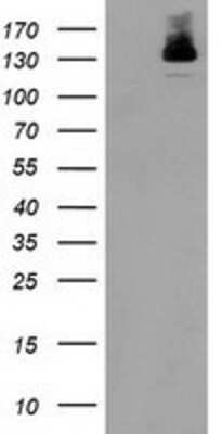 Western Blot: HDAC6 Antibody (OTI1B3) [NBP2-03269]