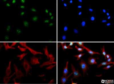 Immunocytochemistry/ Immunofluorescence: HDAC6 Antibody - BSA Free [NBP1-78981]