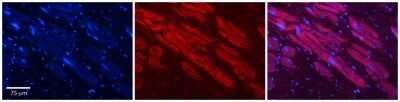 Immunohistochemistry: HDAC6 Antibody [NBP1-69127]