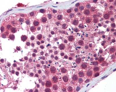 Immunohistochemistry-Paraffin: HDAC6 Antibody [NBP1-69127]