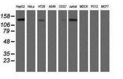 Western Blot: HDAC6 Antibody (OTI1B3)Azide and BSA Free [NBP2-71531]