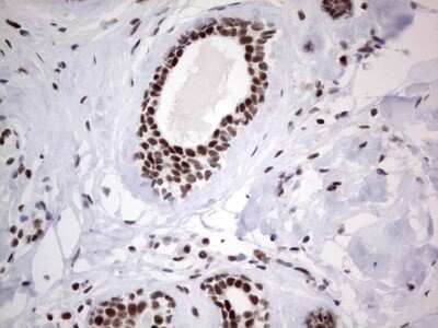 Immunohistochemistry: HDAC9 Antibody (OTI7G2) [NBP2-45952]