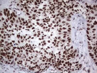 Immunohistochemistry: HDAC9 Antibody (OTI7G2) [NBP2-45952]