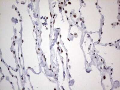 Immunohistochemistry: HDAC9 Antibody (OTI7G2) [NBP2-45952]