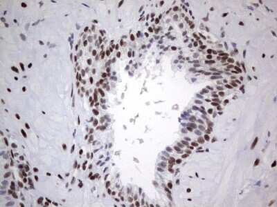 Immunohistochemistry: HDAC9 Antibody (OTI7G2) [NBP2-45952]