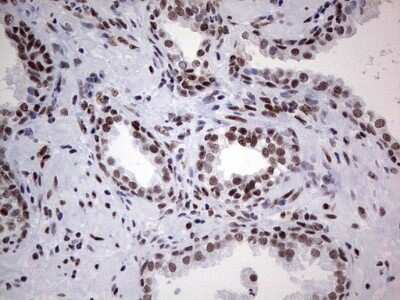 Immunohistochemistry: HDAC9 Antibody (OTI7G2) [NBP2-45952]