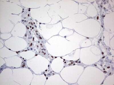 Immunohistochemistry: HDAC9 Antibody (OTI7G2) [NBP2-45952]