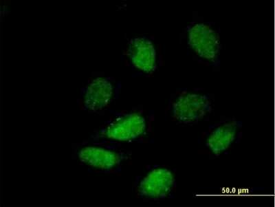 Immunocytochemistry/ Immunofluorescence: HDAC9 Antibody [H00009734-B01P]