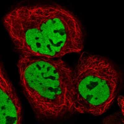 Immunocytochemistry/ Immunofluorescence: HDAC9 Antibody [NBP1-83274]