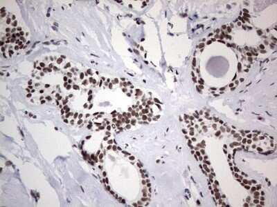 Immunohistochemistry: HDAC9 Antibody (OTI7G2) - Azide and BSA Free [NBP2-71493]
