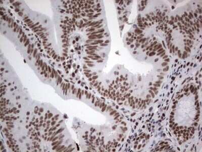 Immunohistochemistry: HDAC9 Antibody (OTI7G2) - Azide and BSA Free [NBP2-71493]