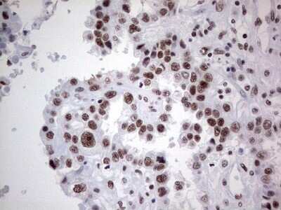 Immunohistochemistry: HDAC9 Antibody (OTI7G2) - Azide and BSA Free [NBP2-71493]
