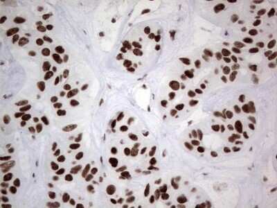 Immunohistochemistry: HDAC9 Antibody (OTI7G2) - Azide and BSA Free [NBP2-71493]