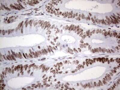 Immunohistochemistry: HDAC9 Antibody (OTI7G2) - Azide and BSA Free [NBP2-71493]