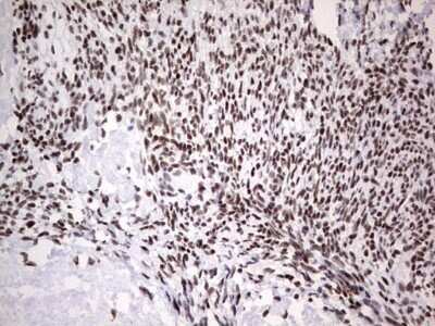 Immunohistochemistry: HDAC9 Antibody (OTI7G2) - Azide and BSA Free [NBP2-71493]